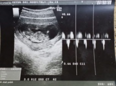 À̹ÌÁö½æ³×ÀÏ 58x58